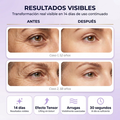 Bálsamo de Colágeno Cálcico DERMINE - Dr. Melaxin